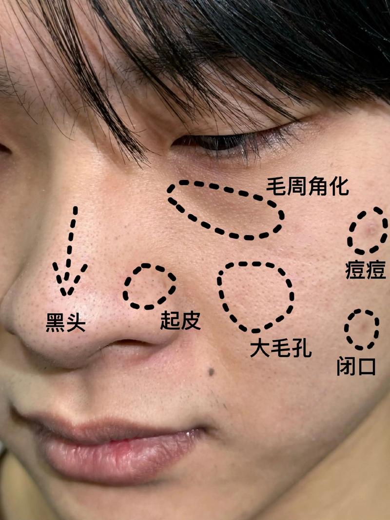 铁岭面部脱毛排行榜2026:价格、口碑与正规机构推荐,专业避
