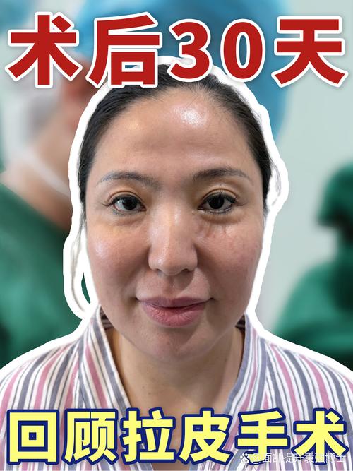 阿坝胶原蛋白填充正规医院推荐及价格参考