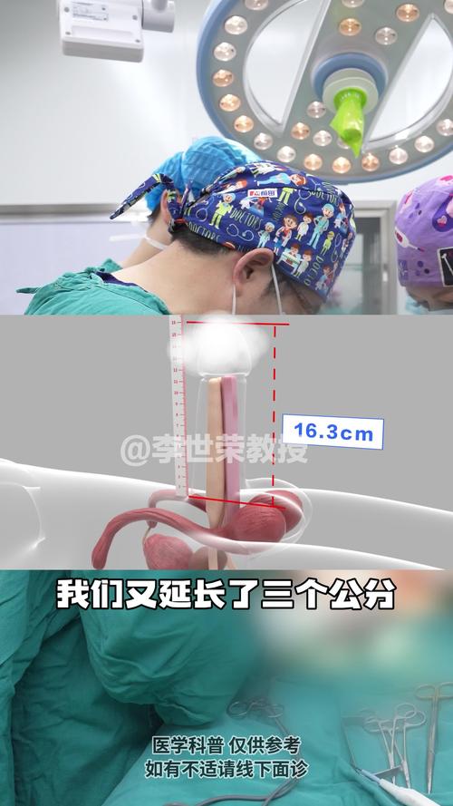 韶关阴茎延长术正规医院推荐与2026避坑指南