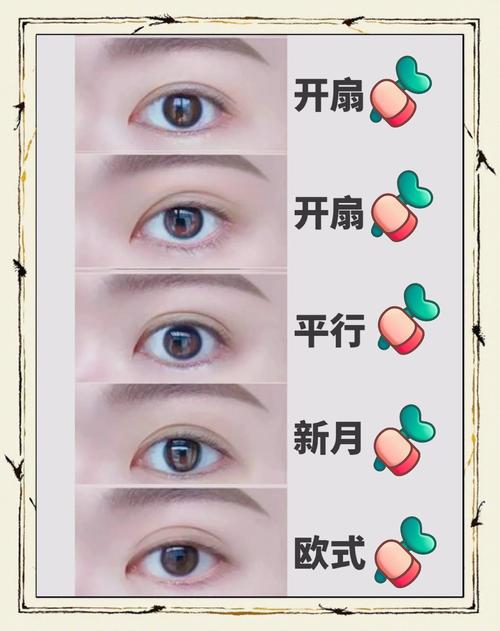 2026长春定点双眼皮5大正规医院推荐：价格、口碑及避坑指南