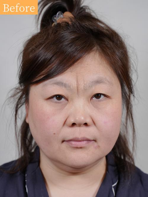 通化飘眉前十名榜单2026：专业机构推荐、价格参考与避坑指南
