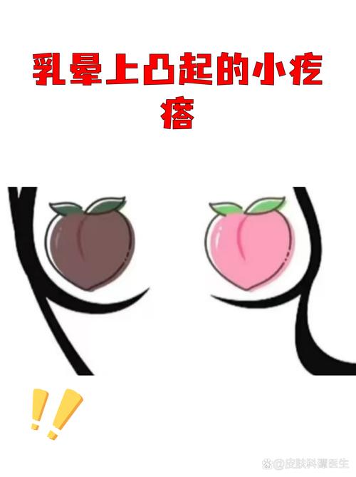 邯郸乳晕缩小哪家正规?2026年价格表与医院推荐指南