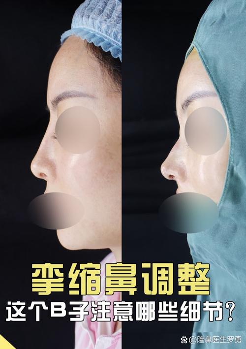 2026嘉兴鼻部修复正规医院推荐 嘉兴鼻部修复前5名榜单深度