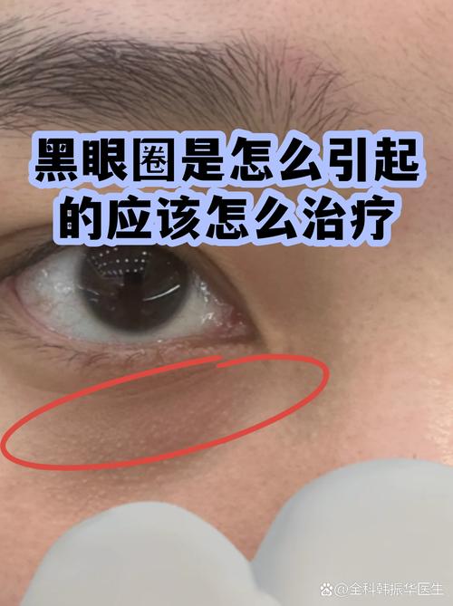 2026伊犁黑眼圈治疗排行榜:正规机构推荐与类型辨别指南