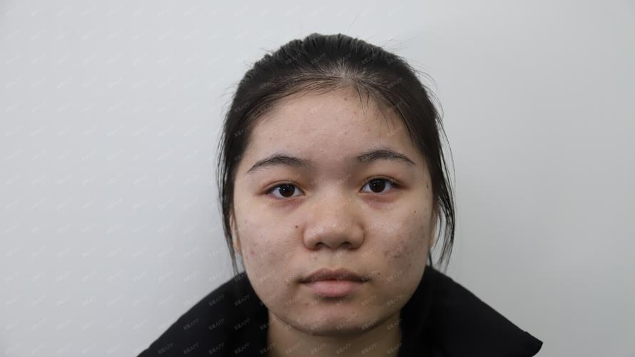 2026石嘴山杏仁酸焕肤榜单:正规医院推荐与价格参考