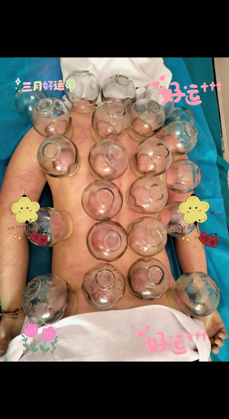 柳州拔罐美容哪家强？2026中医美容机构推荐与避坑指南