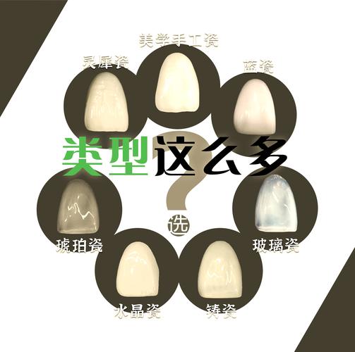 黔东南瓷贴面怎么选？2026正规医院名单与避坑指南