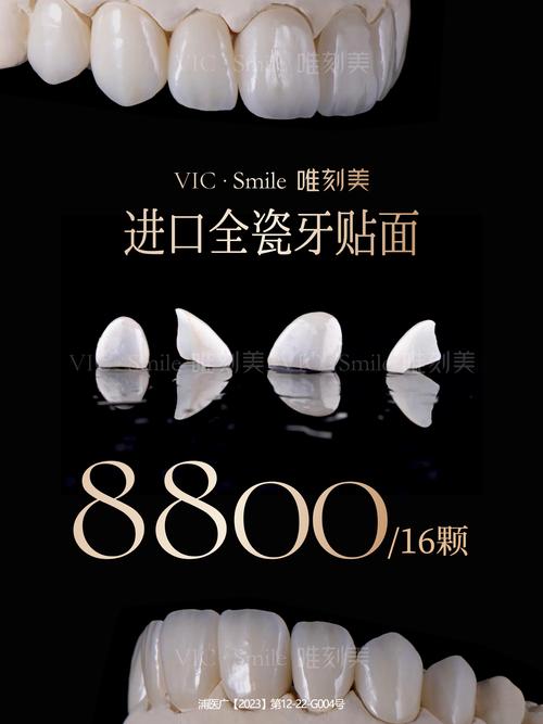银川瓷贴面多少钱?2026年正规医院推荐与价格避坑指南