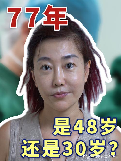 2026巴音郭楞玻尿酸丰下巴正规机构推荐与价格分析