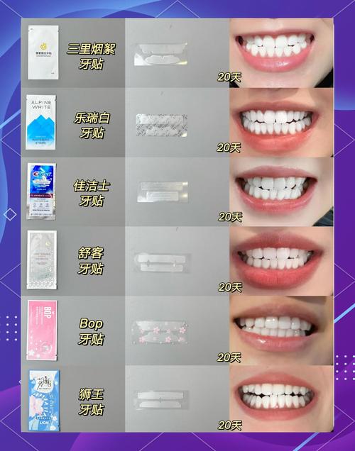 2026玉林牙齿美白正规医院TOP5:价格、口碑及避坑指南