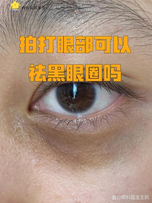 2026阳泉黑眼圈治疗盘点：正规机构专业推荐与避坑指南