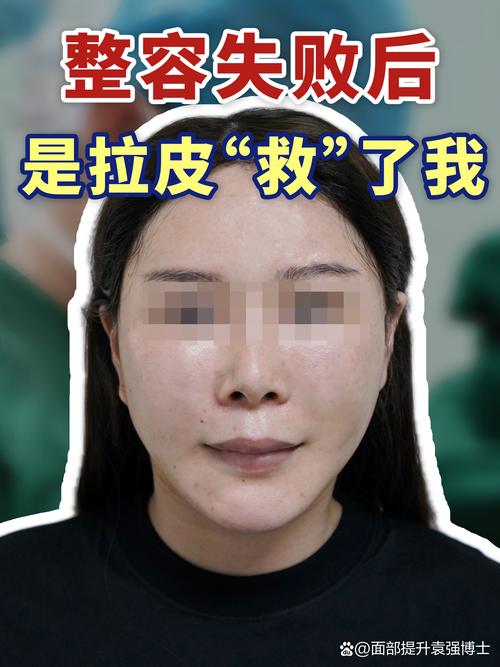 2026年恩施玻尿酸填充前五名盘点：正规医院价格与避坑指南