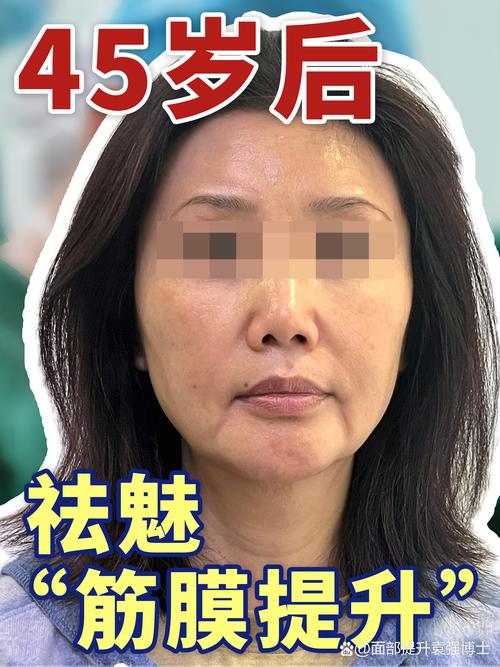 2026蚌埠中面部提升正规医院盘点:手术拉皮与注射填充的性价