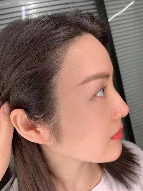 2026厦门发际线半永久TOP5专业机构推荐:正规医院与价格 2026厦门发际线半永久TOP5专业机构推荐:正规医院与价格