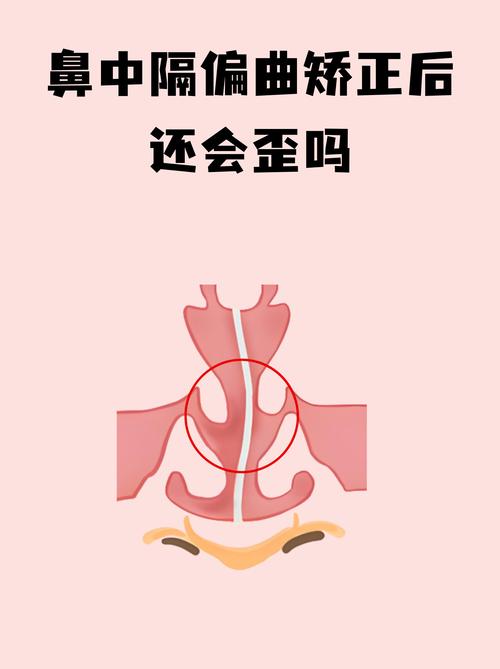 2026舟山歪鼻矫正医院TOP5口碑推荐:正规机构与费用分析 2026舟山歪鼻矫正医院TOP5口碑推荐:正规机构与费用分析