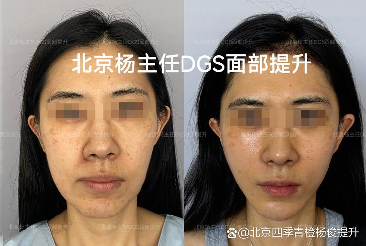 黄冈面部轮廓整形哪家强？2026年正规医院排名与价格趋势解析