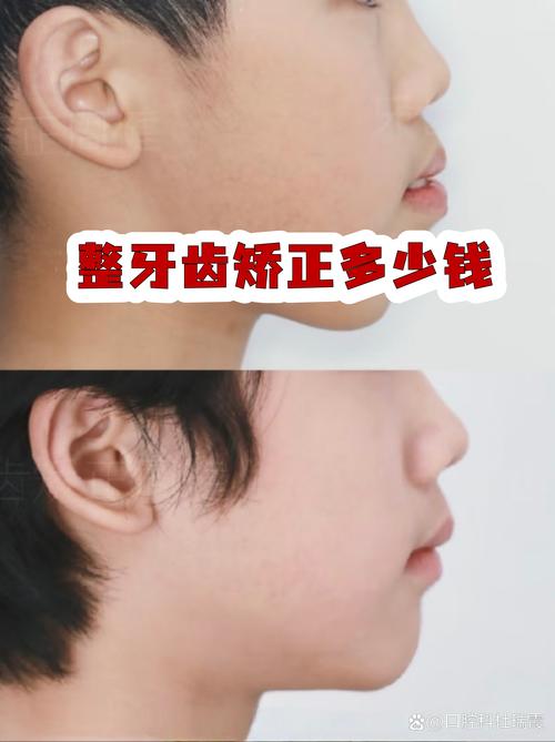 2026年保山牙齿矫正前5名盘点:价格、排名与避坑指南