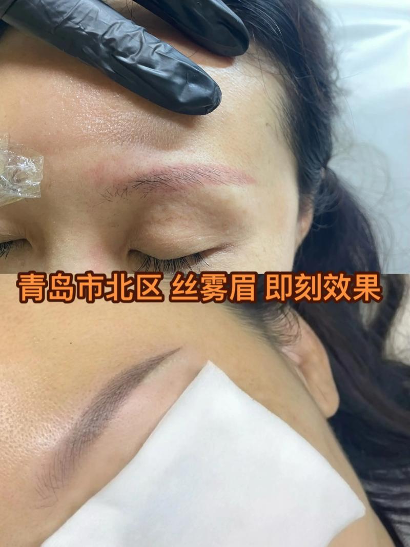 2026青岛丝雾眉口碑排名前十机构推荐，丝雾眉价格表及避坑指