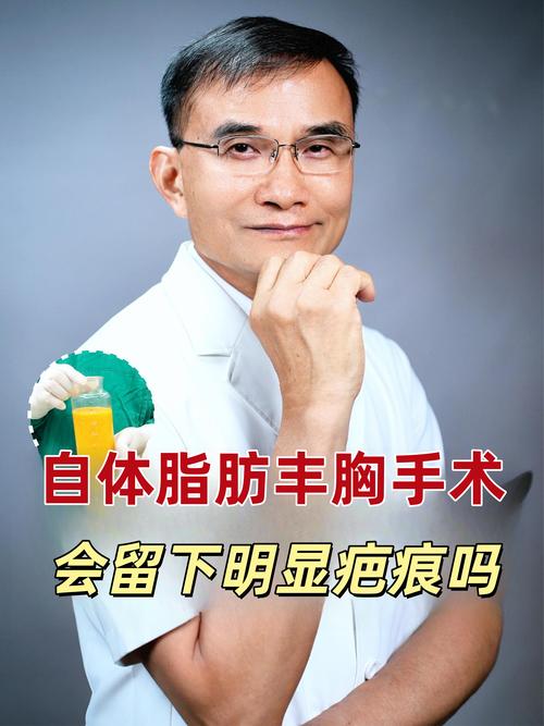 运城自体脂肪丰胸正规医院推荐清单：2026年选医避坑指南