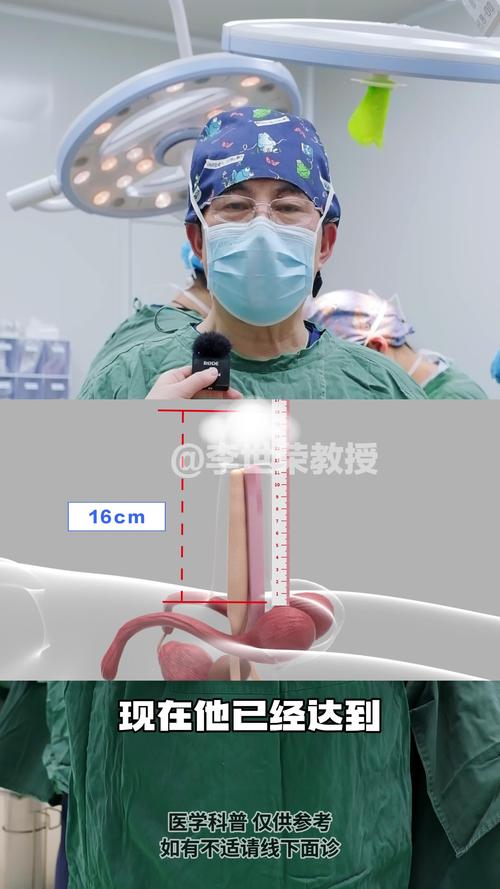 白山阴茎增粗术正规医院推荐与价格避坑指南