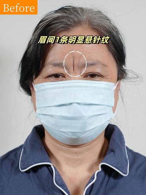 2026年铜川眉弓整形医院排名前十名单发布：价格、口碑与避坑