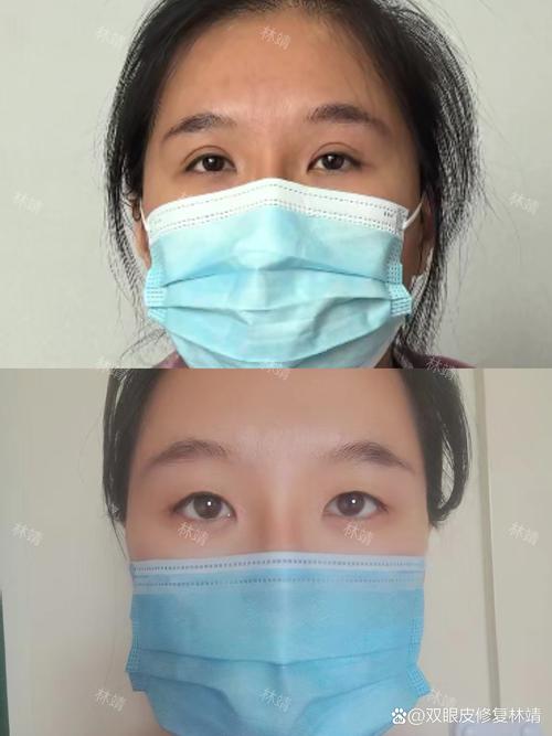2026湖州眼综合整形医院排行榜：前十强推荐、价格及避坑指南