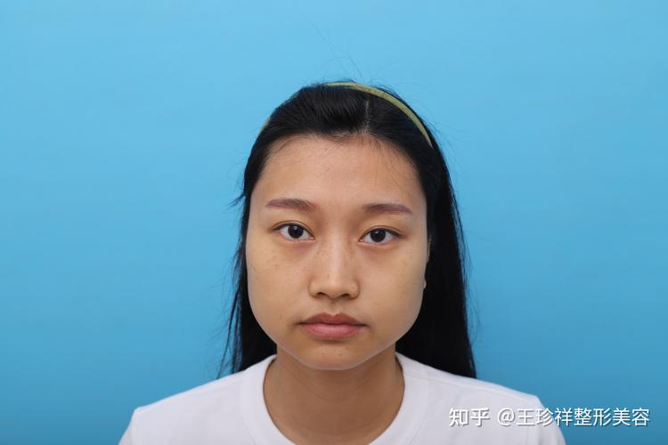 邵阳削骨整形哪家好?2026正规机构口碑盘点与价格参考