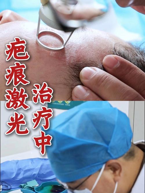 迪庆激光祛疤医院推荐：2026正规医美机构盘点与费用参考
