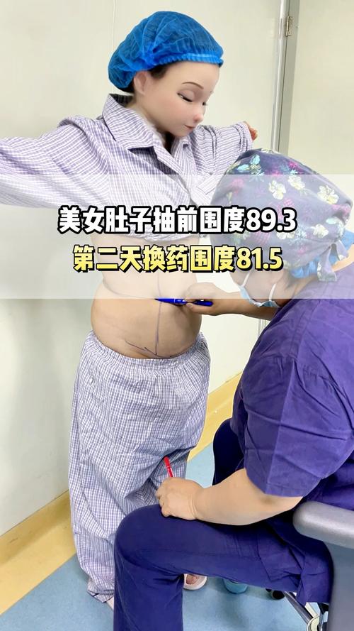林芝腰腹环吸排名2026：正规医院/机构怎么选？价格与口碑深