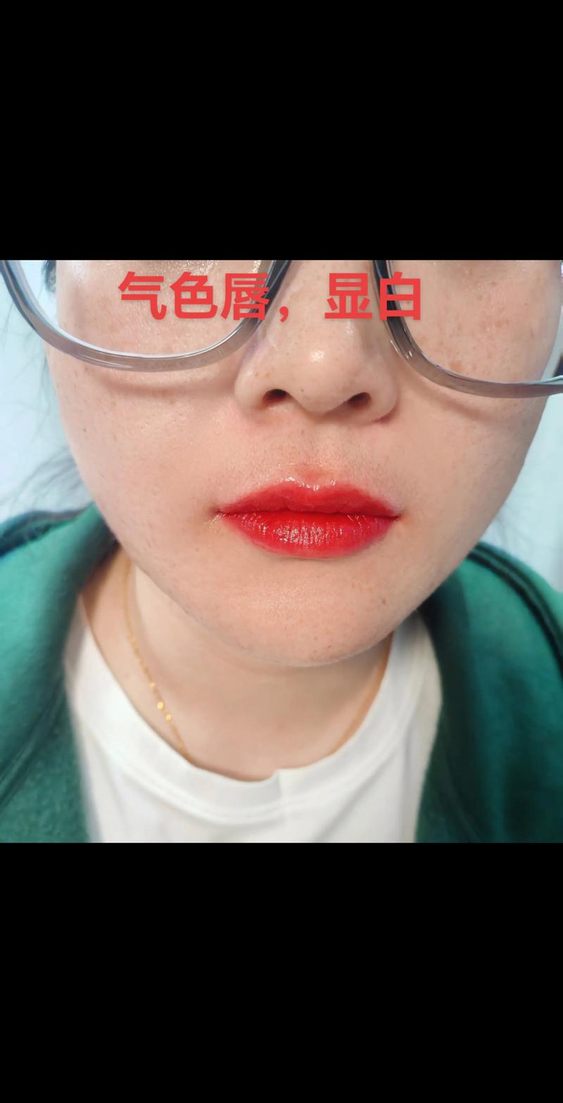 2026青岛漂唇怎么选？正规医院推荐与避坑指南，助你选对“唇