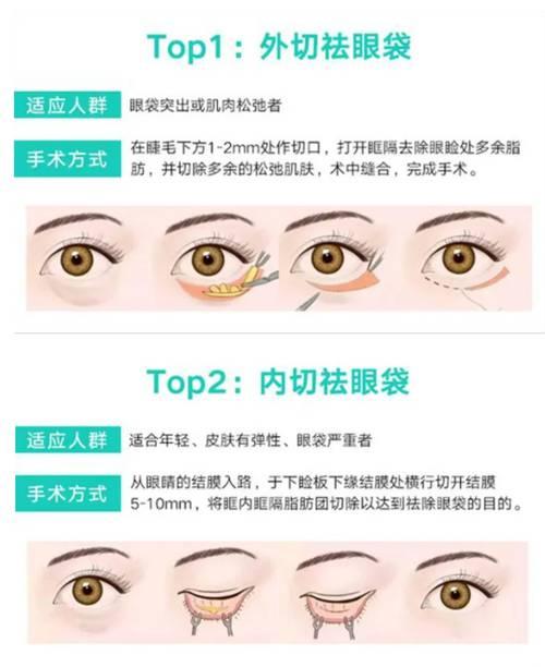2026年南充眼综合整形排名深度测评：如何选择正规机构与技术