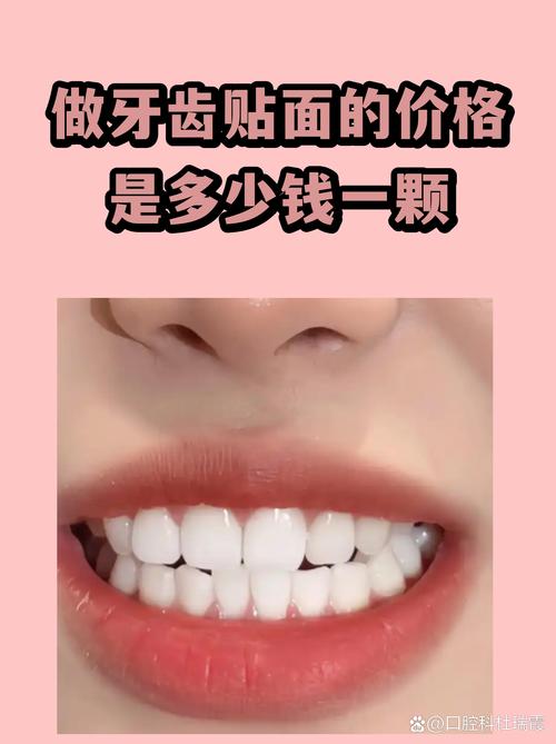 河池瓷贴面费用2026：正规医院推荐、价格分析及避坑指南