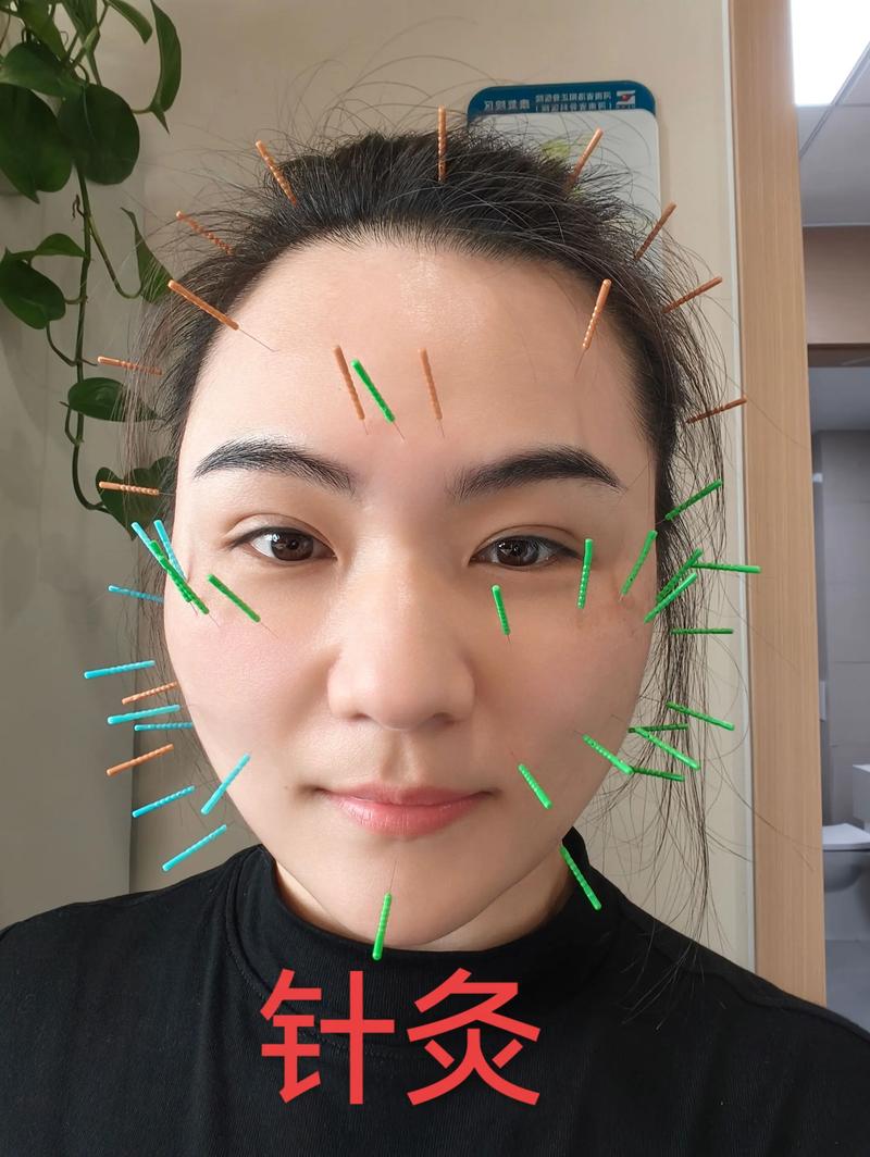 2026德阳针灸美容十强推荐：正规机构排行榜与价格参考