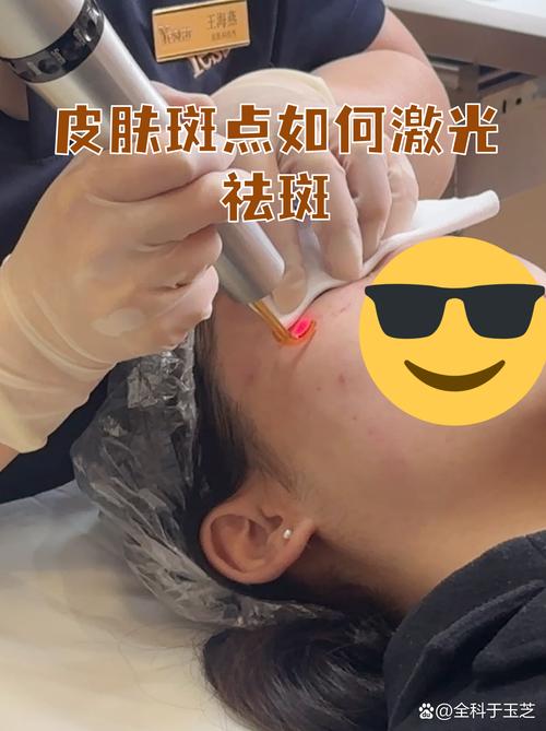 苏州激光祛斑专业指南：2026年价格、口碑与避坑攻略