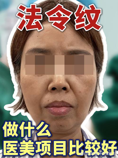 安阳法令纹填充十强推荐2026：专业机构盘点与避坑指南