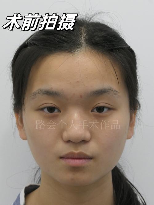 2026遂宁面部轮廓整形正规医院推荐:价格排名与口碑避坑指南