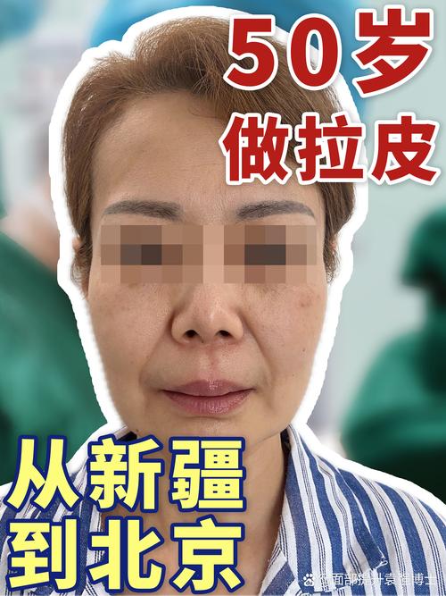 嘉峪关皮肤磨削正规医院排行榜2026:价格、口碑与避坑指南