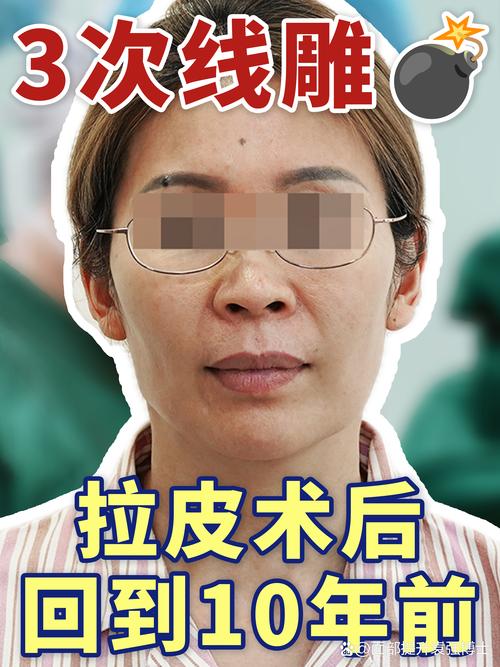 2026昭通线雕提升十强推荐：专业机构盘点与费用参考