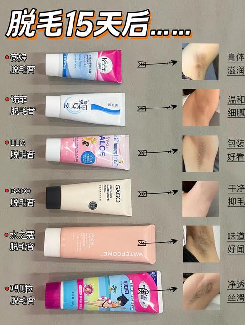 遂宁腿部脱毛怎么选?2026正规医美机构推荐与避坑指南