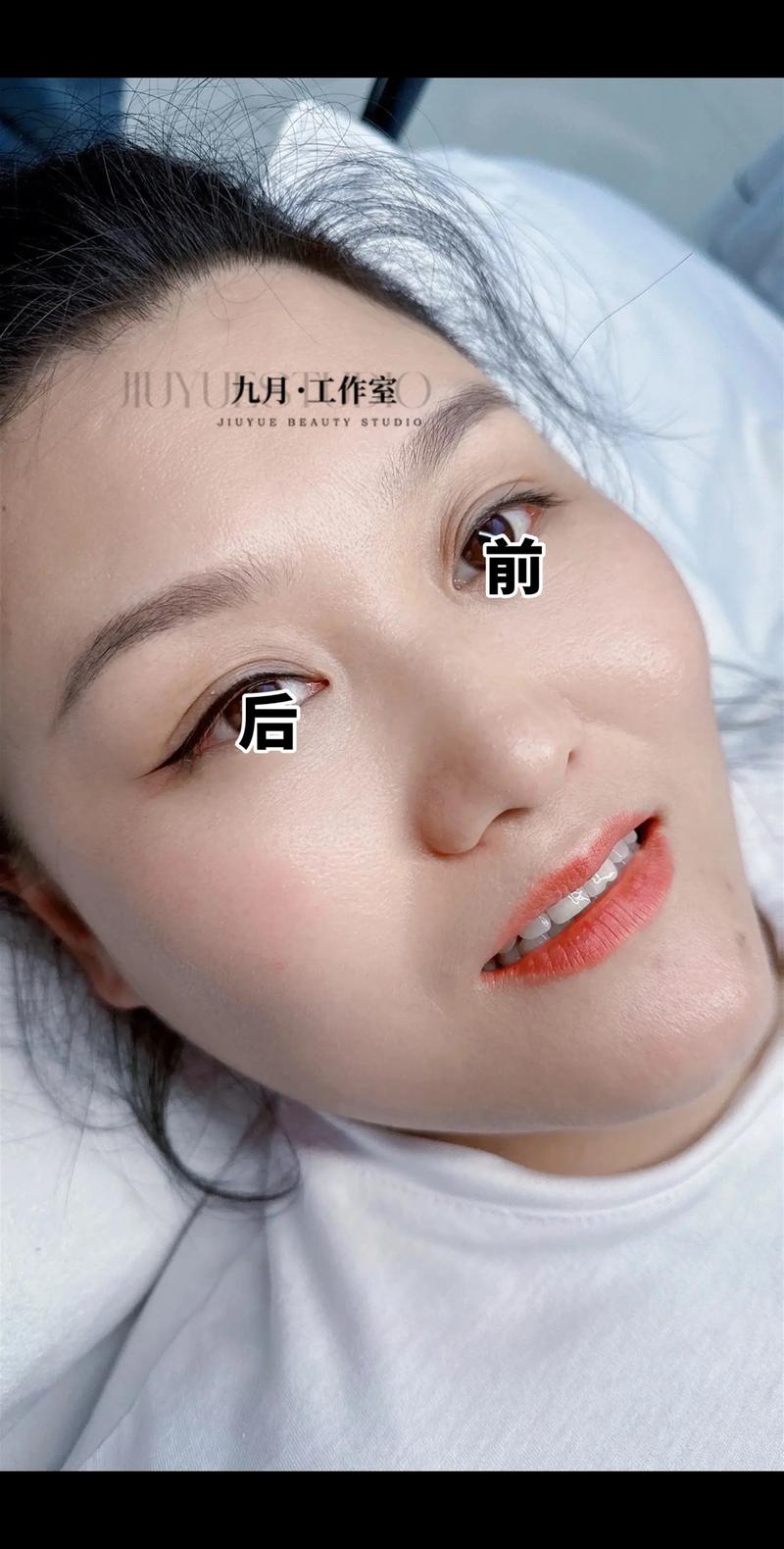 周口美瞳线2026年行业分析:前三强正规机构推荐及价格避坑指