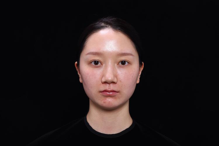 2026年芜湖玻尿酸填充哪家强？正规医院推荐与价格费用盘点
