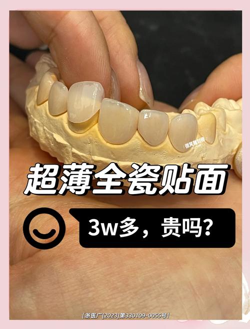 长春瓷贴面TOP3推荐2026：价格、口碑与避坑指南