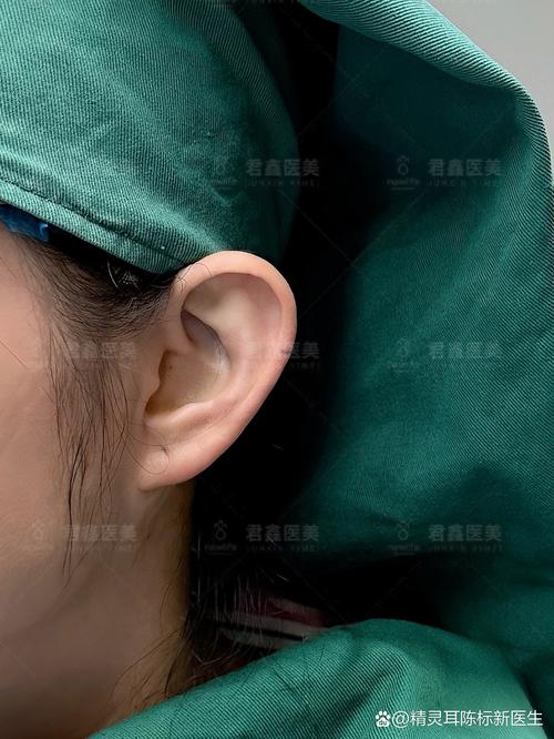 2026运城精灵耳整形最新价格表与专业医院推荐：前三强榜单解