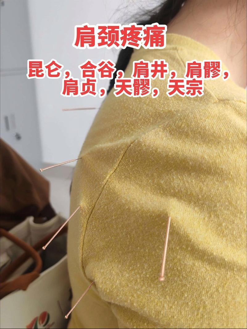 2026沈阳肩颈针推荐：正规医院TOP5名单与专业避坑指南
