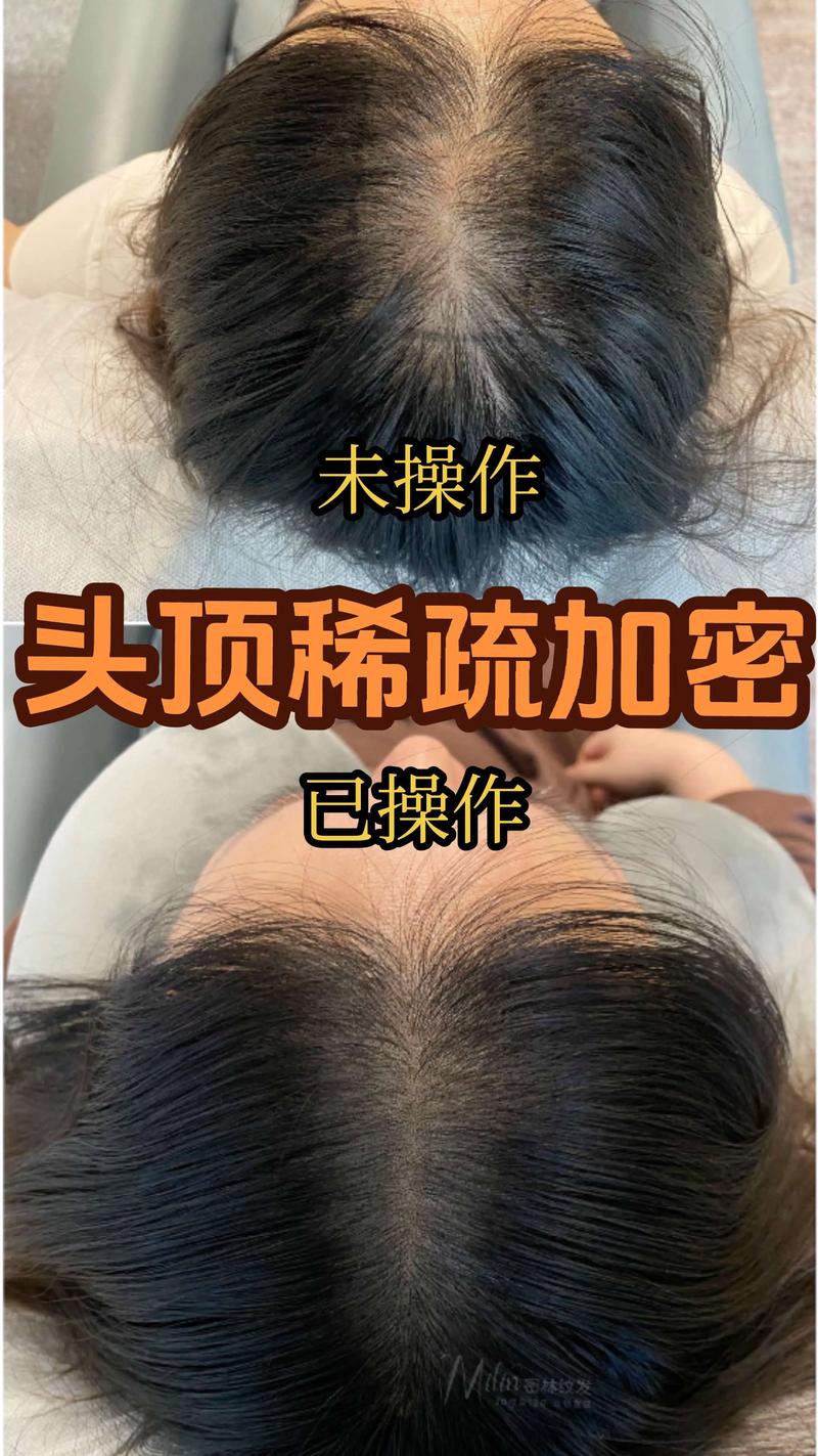 江门头顶加密前五推荐：2026年正规机构盘点与避坑指南