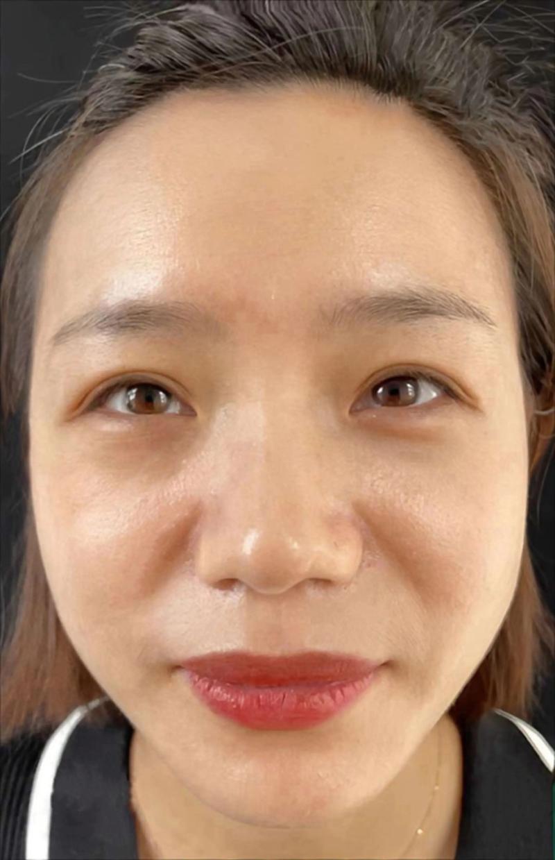 济南自体脂肪丰苹果肌TOP3盘点：2026年正规机构推荐与价