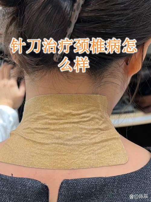 2026太原肩颈针口碑盘点:正规机构推荐与价格参考
