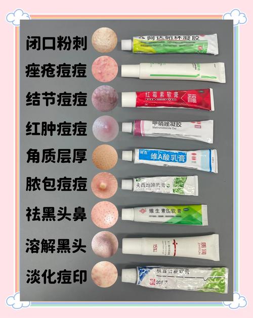 韶关祛痘印避坑指南:2026年正规医院TOP5排名与价格参考