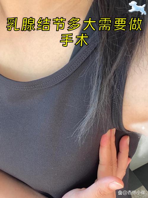 2026南京乳晕缩小手术价格表参考:正规机构推荐与避坑指南