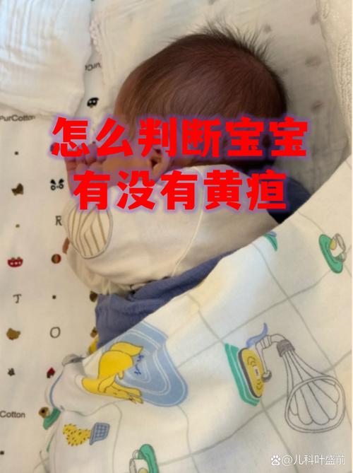 2026六盘水本地新生儿黄疸观察十强推荐:专业护理守护宝宝健